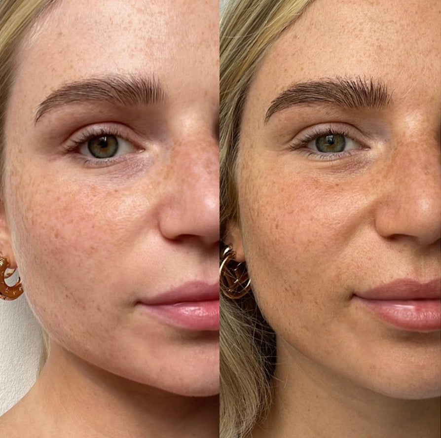 Tan-Luxe - The Face (Gouttes Auto-Bronzantes Sur Mesure) Teinte Light / Medium | Pâle / Moyen